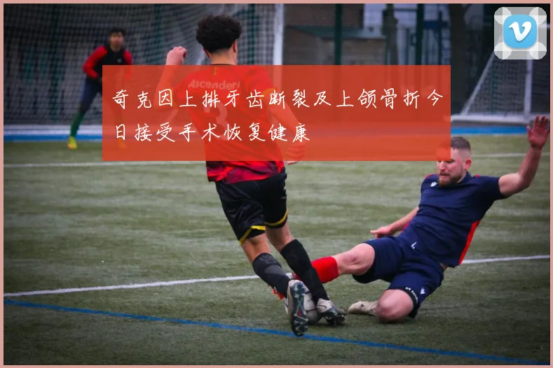 奇克因上排牙齿断裂及上颌骨折今日接受手术恢复健康